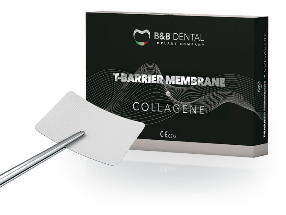 Rigenerazione ossea tbarrier collagene