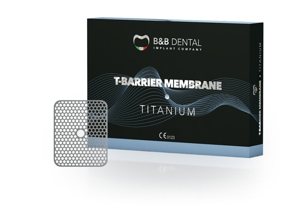 Rigenerazione ossea t-barrier titanio
