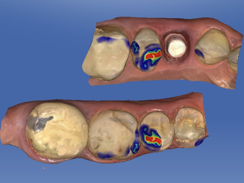 Odontotecnica Digitale 3