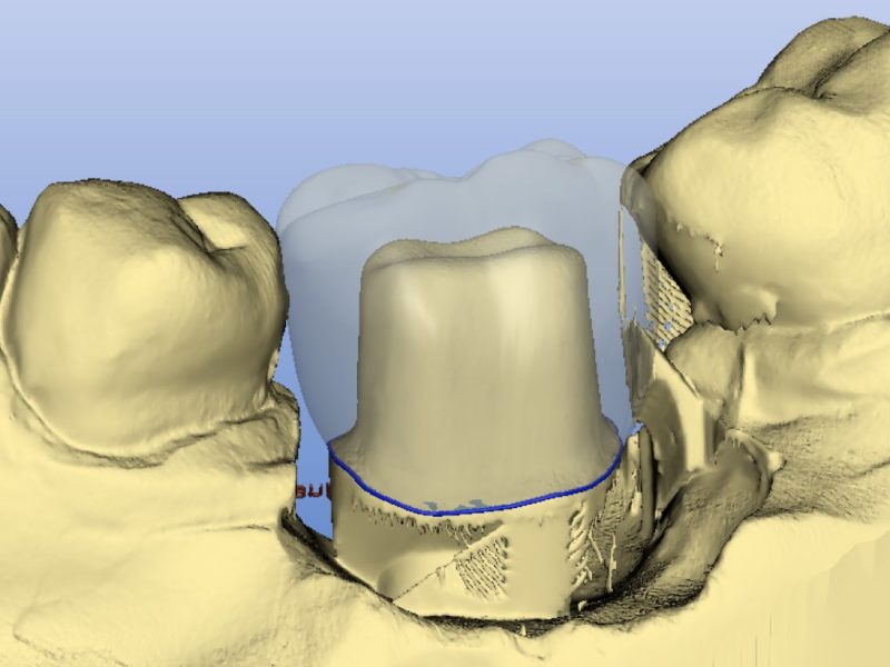 Odontotecnica Digitale
