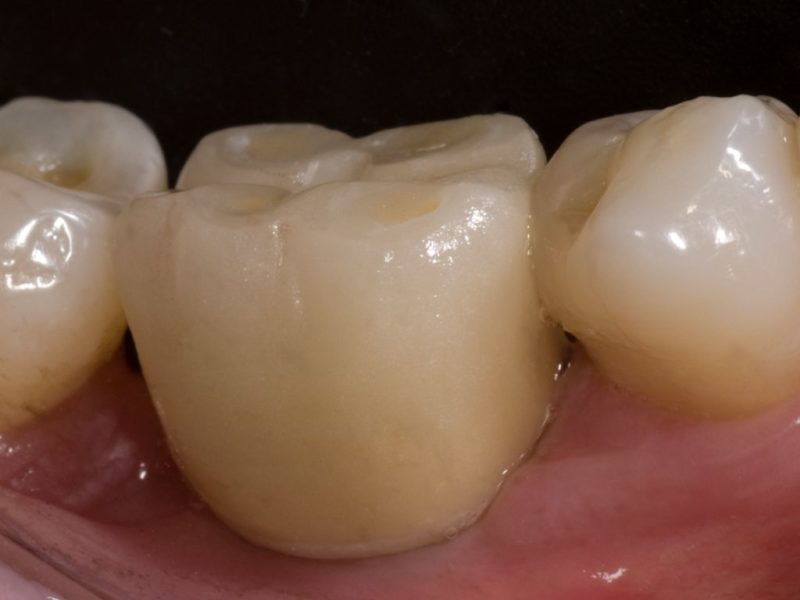 Odontotecnica Digitale